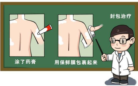 为何潍坊银屑病医院光疗效果好