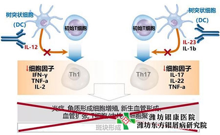 乌司奴单抗医保最新价格