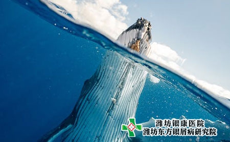 牛皮肤癣后期的康复症状图片