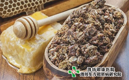 牛皮癣患者要忌口的食物有哪些?维生素D的作用?