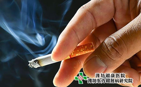 全身性牛皮癣应该怎么治疗?可以吸烟吗?