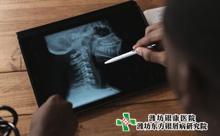 大腿小腿上有牛皮肤癣的症状图片