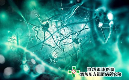 银屑病的症状表现有哪些?如何预防?