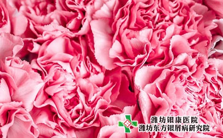 银屑病的症状表现有哪些?如何预防?
