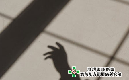牛皮肤癣早期的症状图片药膏图片