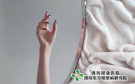 牛皮肤癣初期症状的图片轻度图片