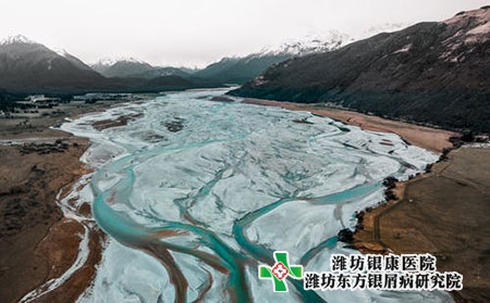 银屑病患者如何选择食物?注意事项?