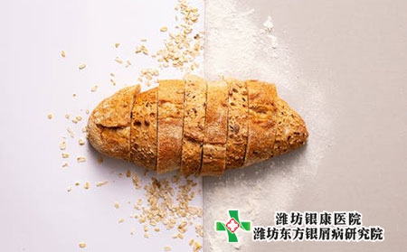 枣庄治疗银屑病的医院怎么样