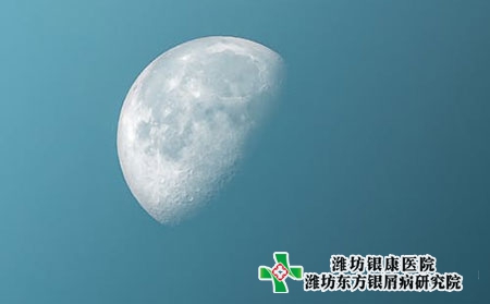 牛皮癣的治疗原则是什么?应该注意些什么?