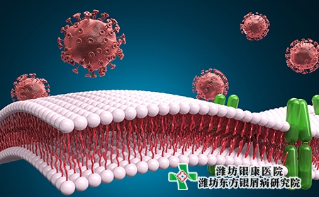 牛皮癣的病因有哪些?诊断依据有哪些?