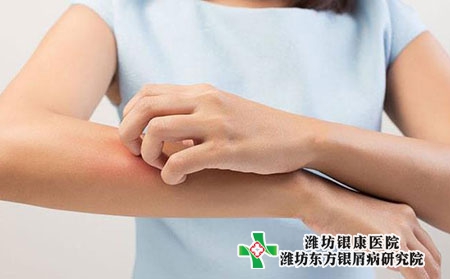 女性银屑病患者容易复发的原因是什么?保健措施?