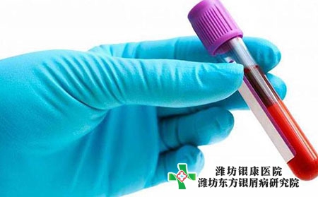 牛皮肤癣到底是怎么引起的?应该如何防治?