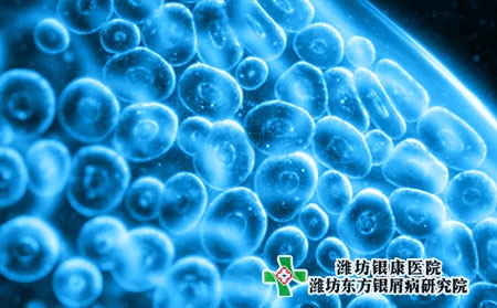牛皮肤癣会传染吗?治疗方法有哪些?