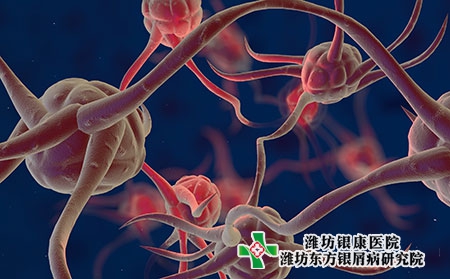 中国治疗牛皮癣的医院哪里比较好