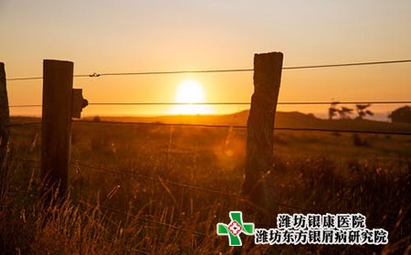 潍坊治疗银屑病医院到底能不能治好