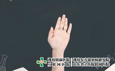 【山东银屑病热搜东方】如何判断关节型银屑病的症状特征呢