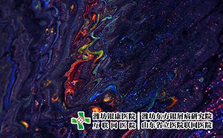 [潍坊银屑病专科研究院虞和路]银屑病的病因是什么呢?