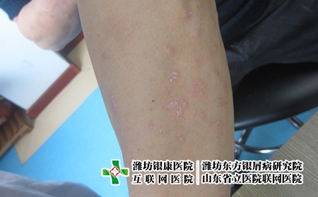 潍坊牛皮屑中医上如何分类?牛皮屑有哪些种类?
