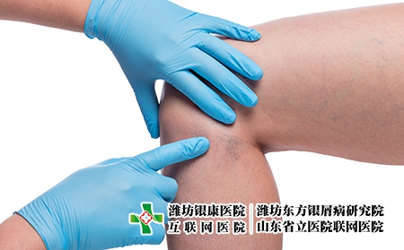 摄图网_303522806_医生亲手检查女腿和紧闭的容器上变血管（企业商用）关节