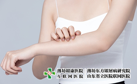摄图网_501700721_皮肤过敏抓挠手臂的女性（企业商用）