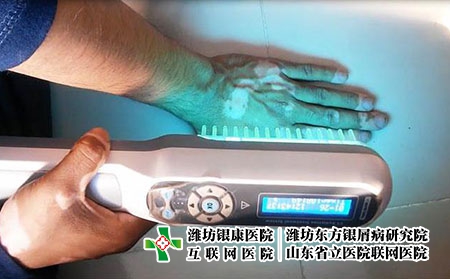 2 (200)光疗