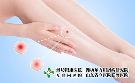 摄图网_500774826_皮肤发炎（企业商用）