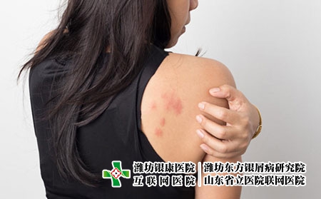 肩膀 症状