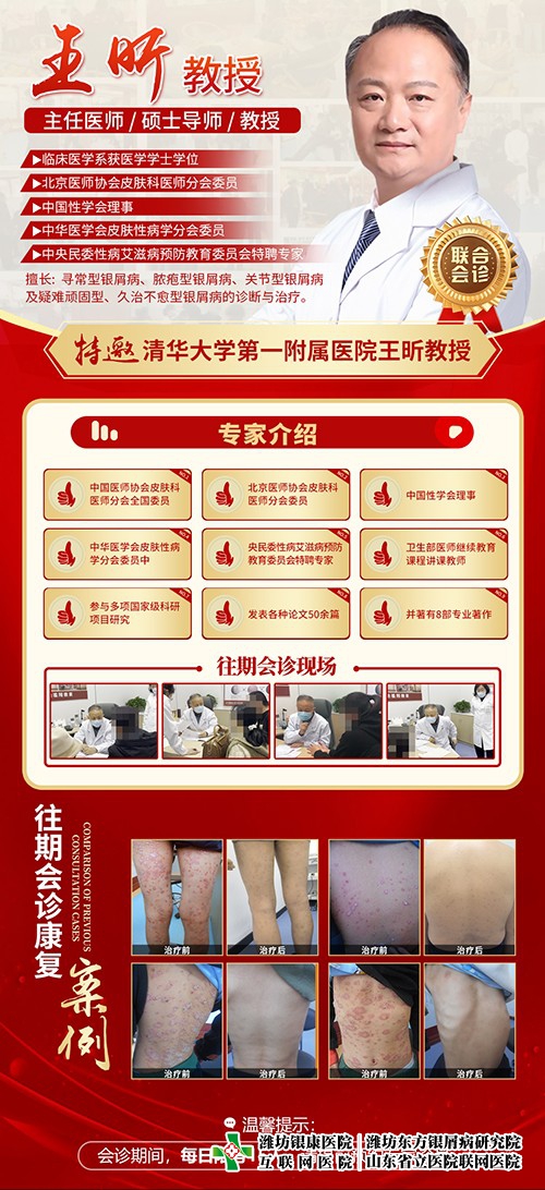 王昕到潍坊东方银屑病研究院（潍坊银康医院）会诊