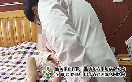 山东银屑病名医团队 - 潍坊东方银屑病研究院 (潍坊银康医院) 山东银屑病名医团队 - 潍坊东方银屑病研究院 (潍坊银康医院)