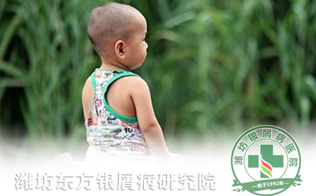 牛皮癣的辅助治疗方法你了解多少