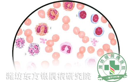 春季牛皮癣患者如何预防感染
