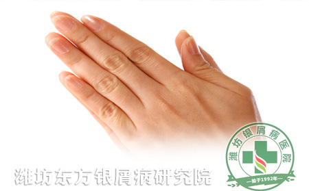 手部牛皮癣怎么护理