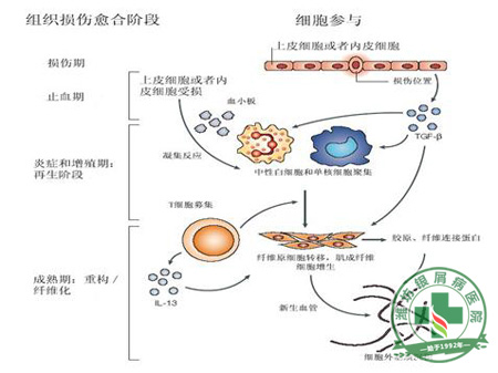 银屑病可不药而愈