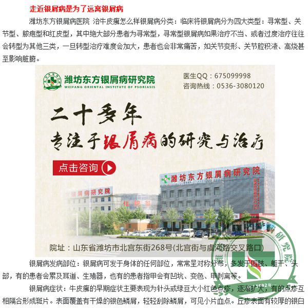 潍坊东方银屑病研究院治银屑病怎么样