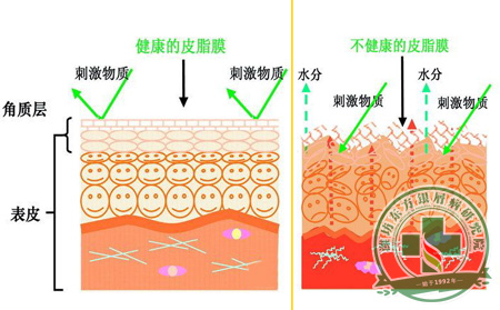 调整：银屑病患者夏季如何促使面部肌肤水润光泽