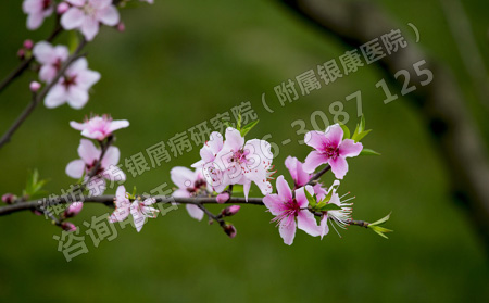 造成银屑病数十年避免复发的护理方法