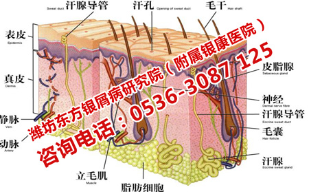 银屑病会增加皮肤癌