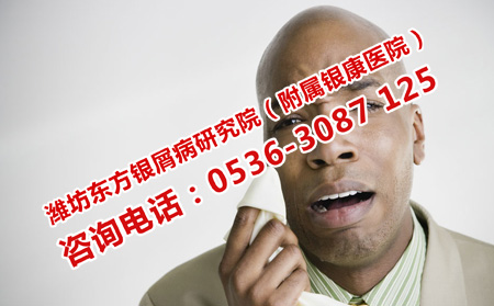 潍坊能不能好的牛皮癣