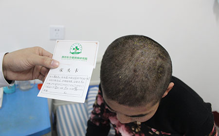 山东治牛皮癣的医院