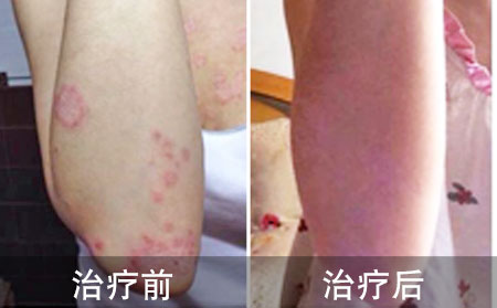 孟晨星医生感谢信