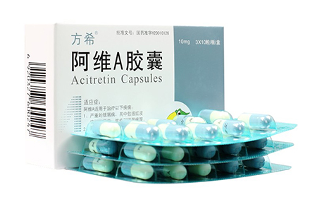 阿维A（Soriatane）治疗银屑病牛皮癣